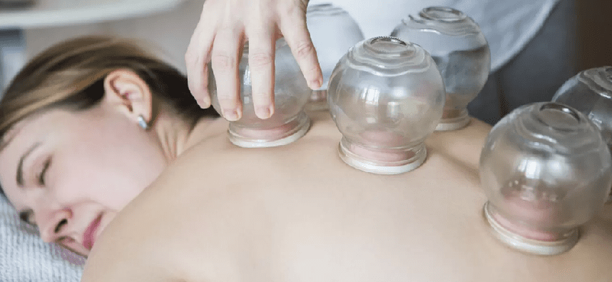 Discover the Holistic Benefits of Cupping Therapy